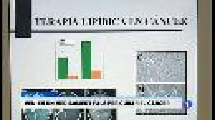 Informatiu Balear - Informatiu Balear 2 - 11/04/17