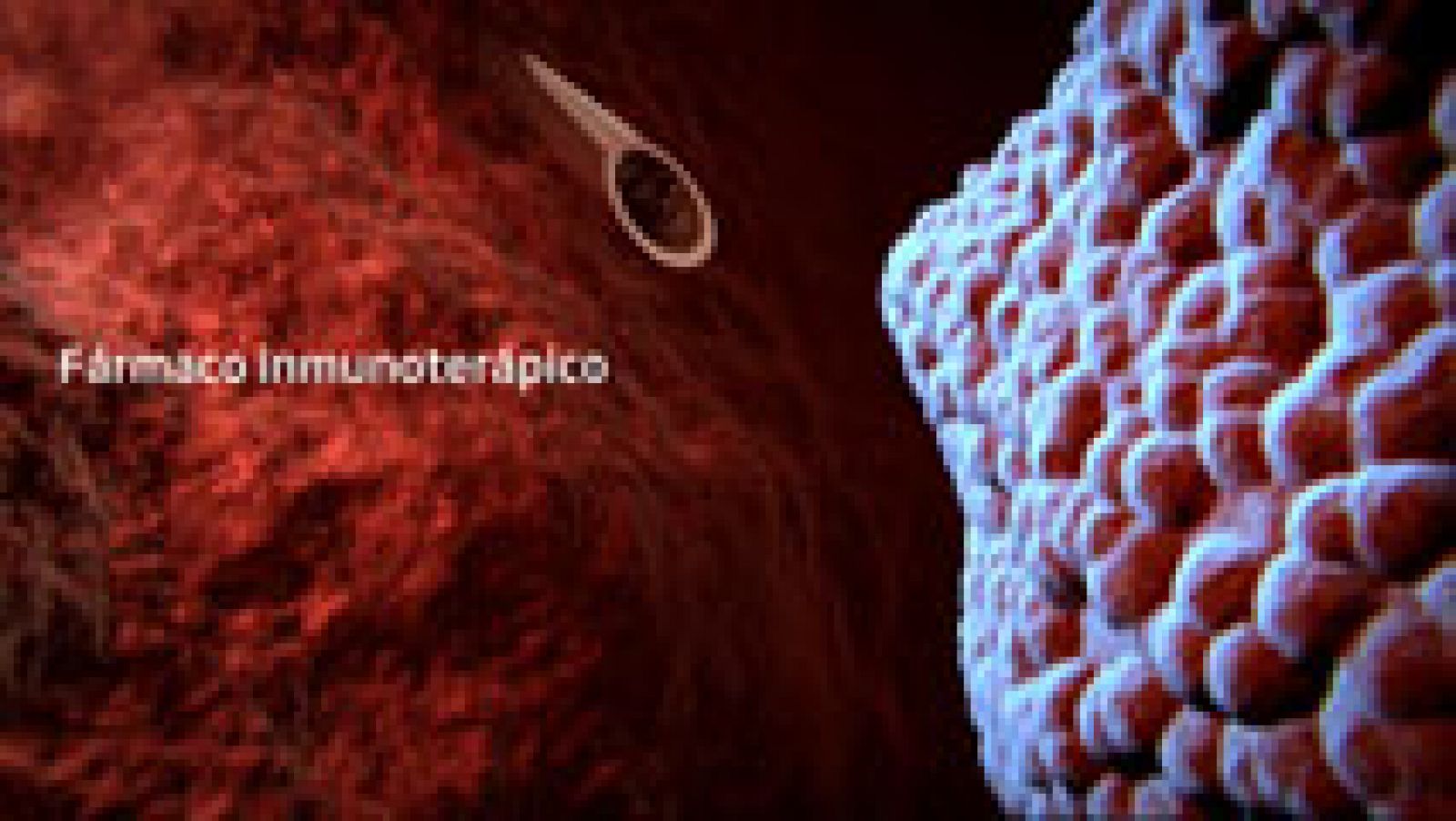 Investigadores españoles demuestran la eficacia de un fármaco contra el cáncer de hígado avanzado