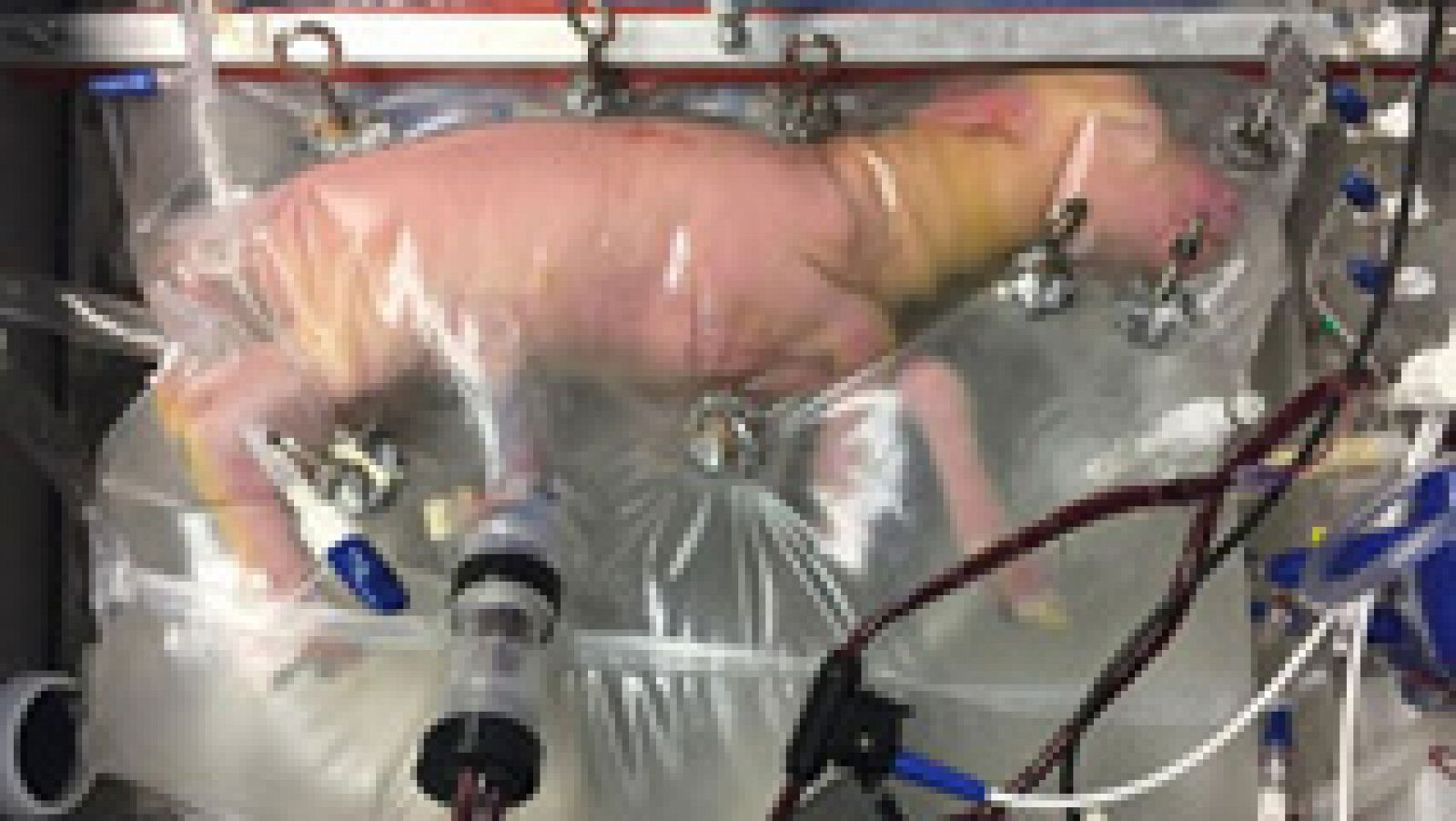 Telediario 1: Un útero artificial logra mantener con vida a fetos de cordero prematuros | RTVE Play