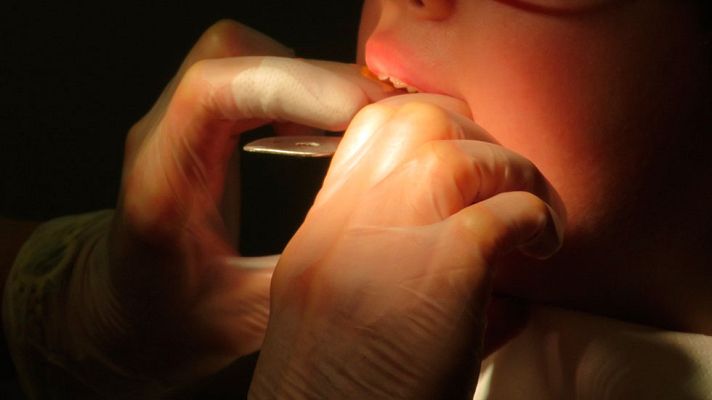 Telediario 1 - Dentistas solidarios