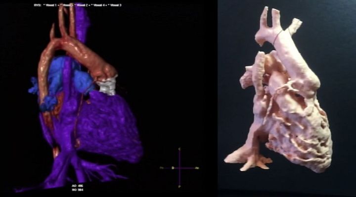 Lab24 - Frenar el párkinson y ciudades inteligentes