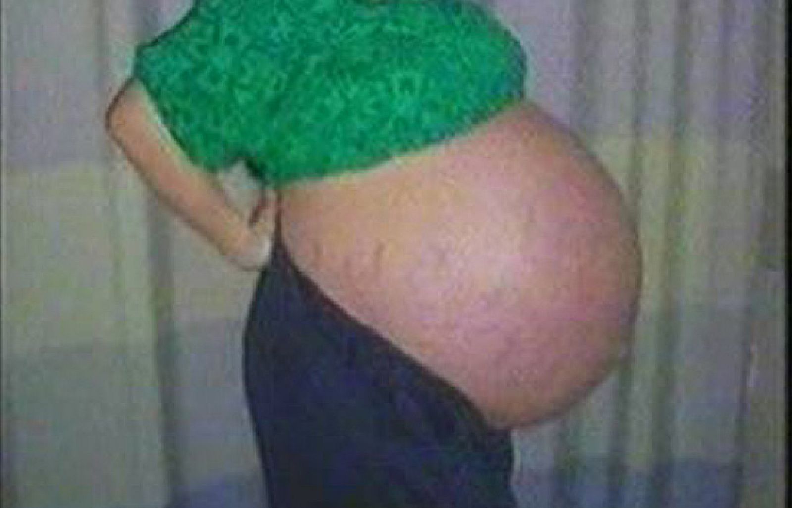 Asombrosa barriga de la madre de los octillizos antes de dar a luz