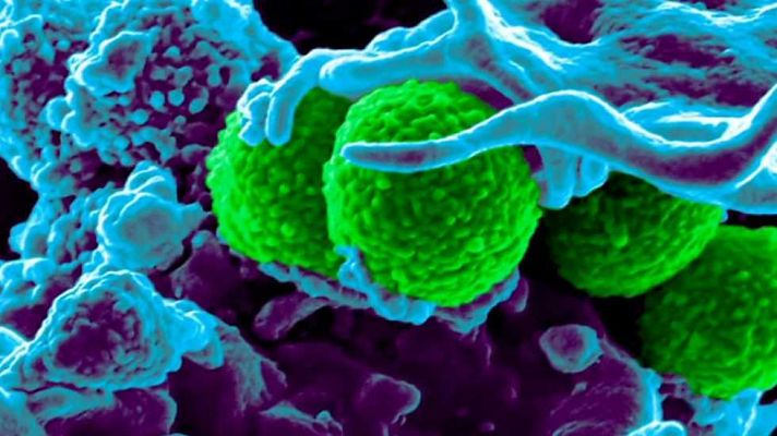 El escarabajo verde - La tormenta perfecta