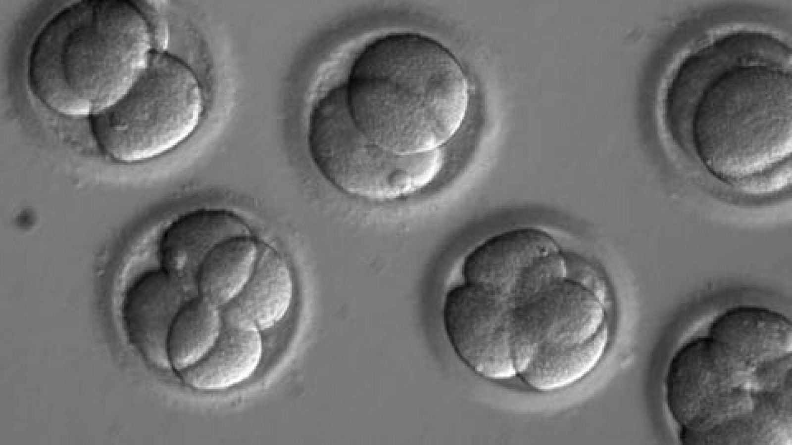 Telediario 1: Logran por primera vez corregir una mutación en embriones humanos | RTVE Play