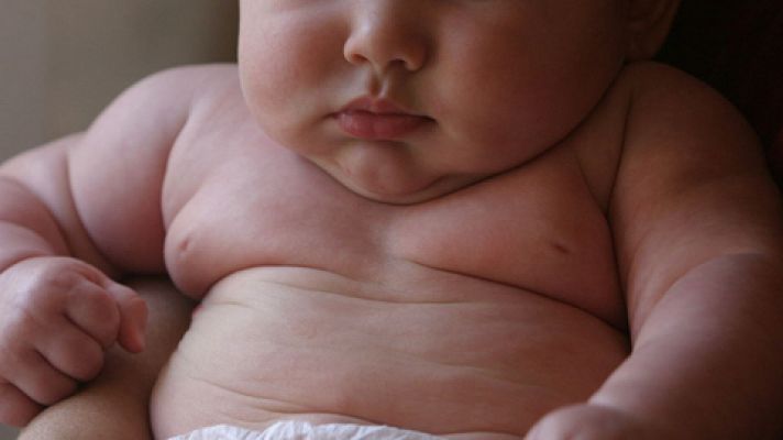 Telediario 1 - La obesidad infantil se ha multiplicado por diez desde 1975