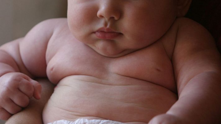 La obesidad infantil se ha multiplicado por diez desde 1975