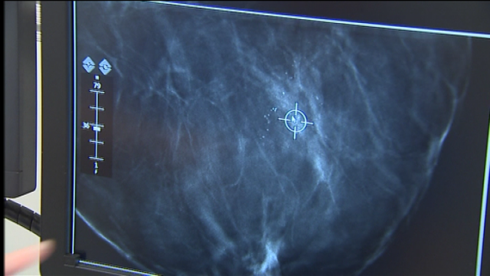 Telecanarias 2 - 19/10/2017