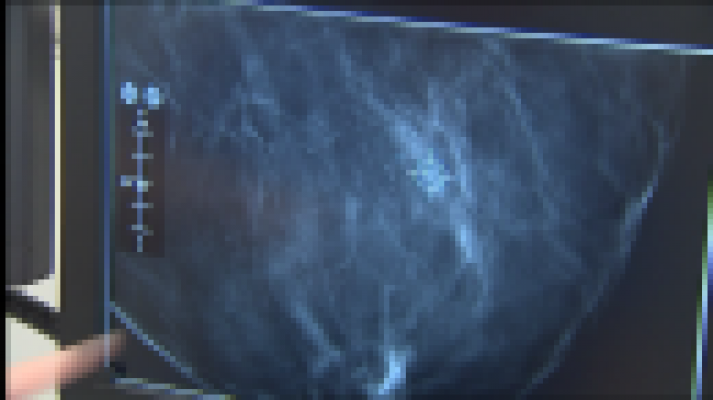 Telecanarias - Telecanarias 2 - 19/10/2017