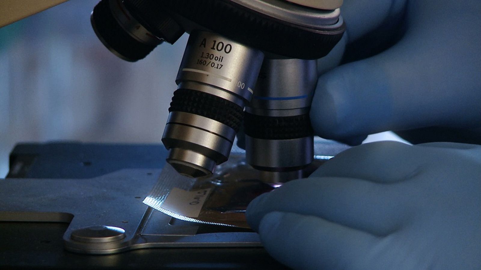 La noche temática - Cáncer, la pista olvidada - ver ahora