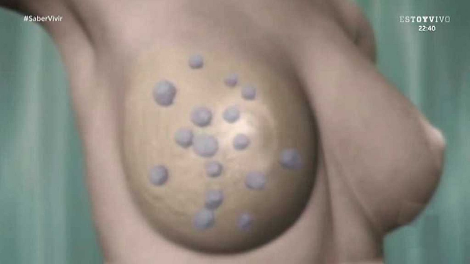 Saber vivir - 26/10/17 - ver ahora