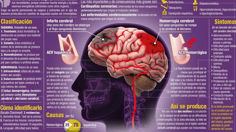 Se celebra el Día Mundial del Ictus
