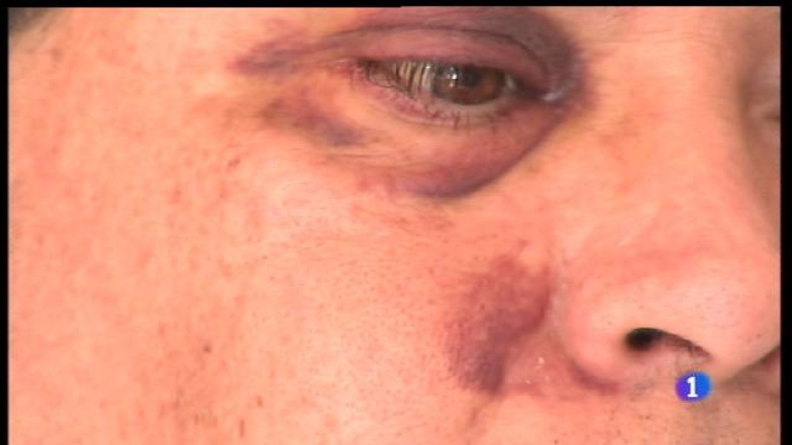 El metge de Muro que va ser agredit per un pacient.