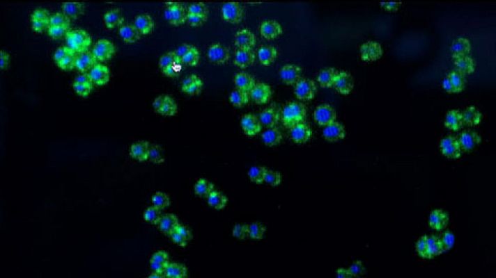 Telediario 1 - Diseñan nuevas moléculas capaces de fulminar la resistencia a los antibióticos