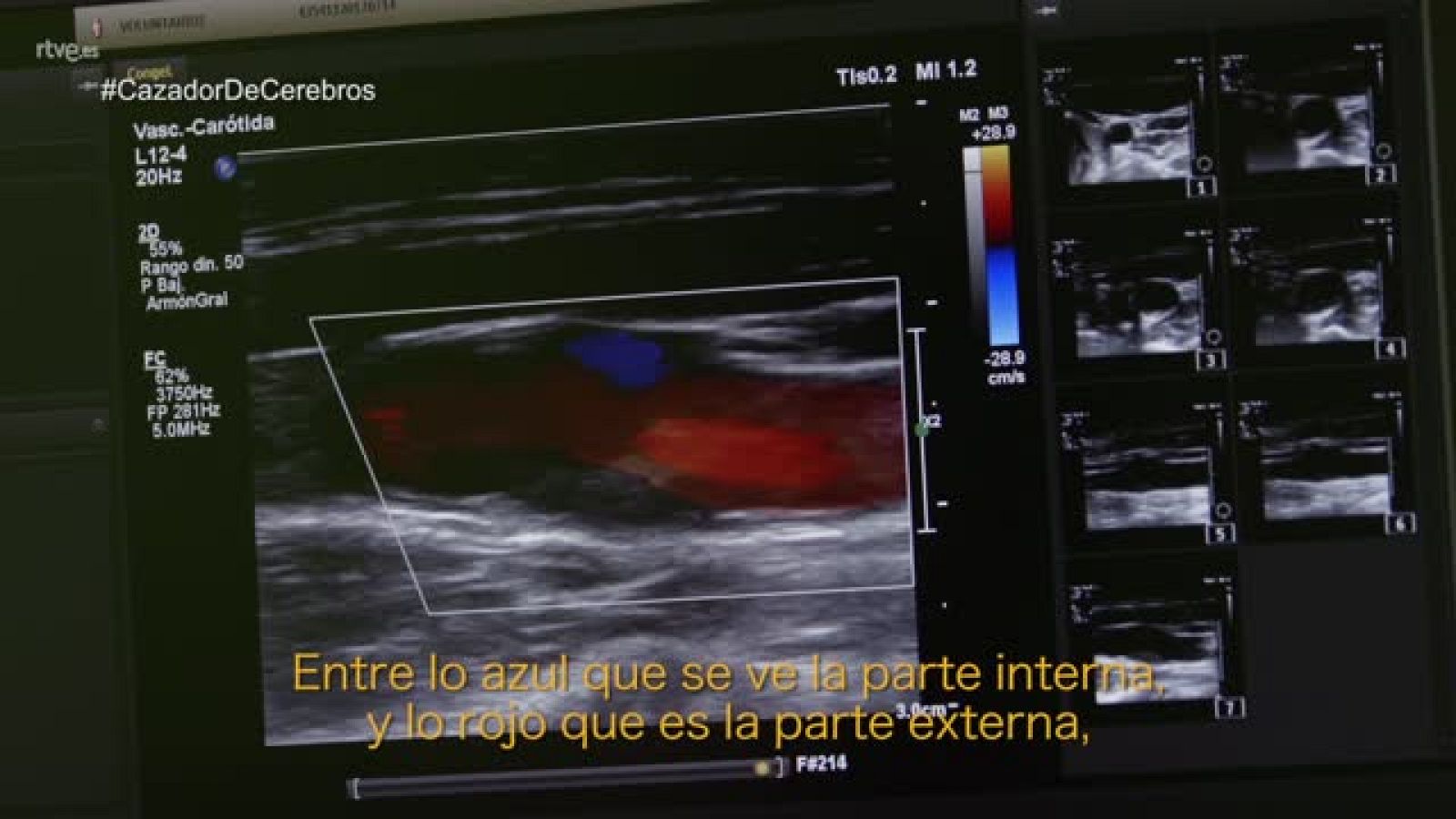 El cazador de cerebros - Curarse en salud - avance