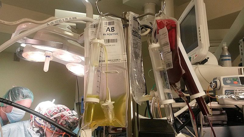 Primer trasplante de corazón con sangre incompatible a una bebé de cinco meses