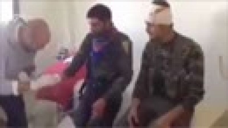 Milicianos kurdos heridos son atendidos en el hospital de Avrin en Afrín
