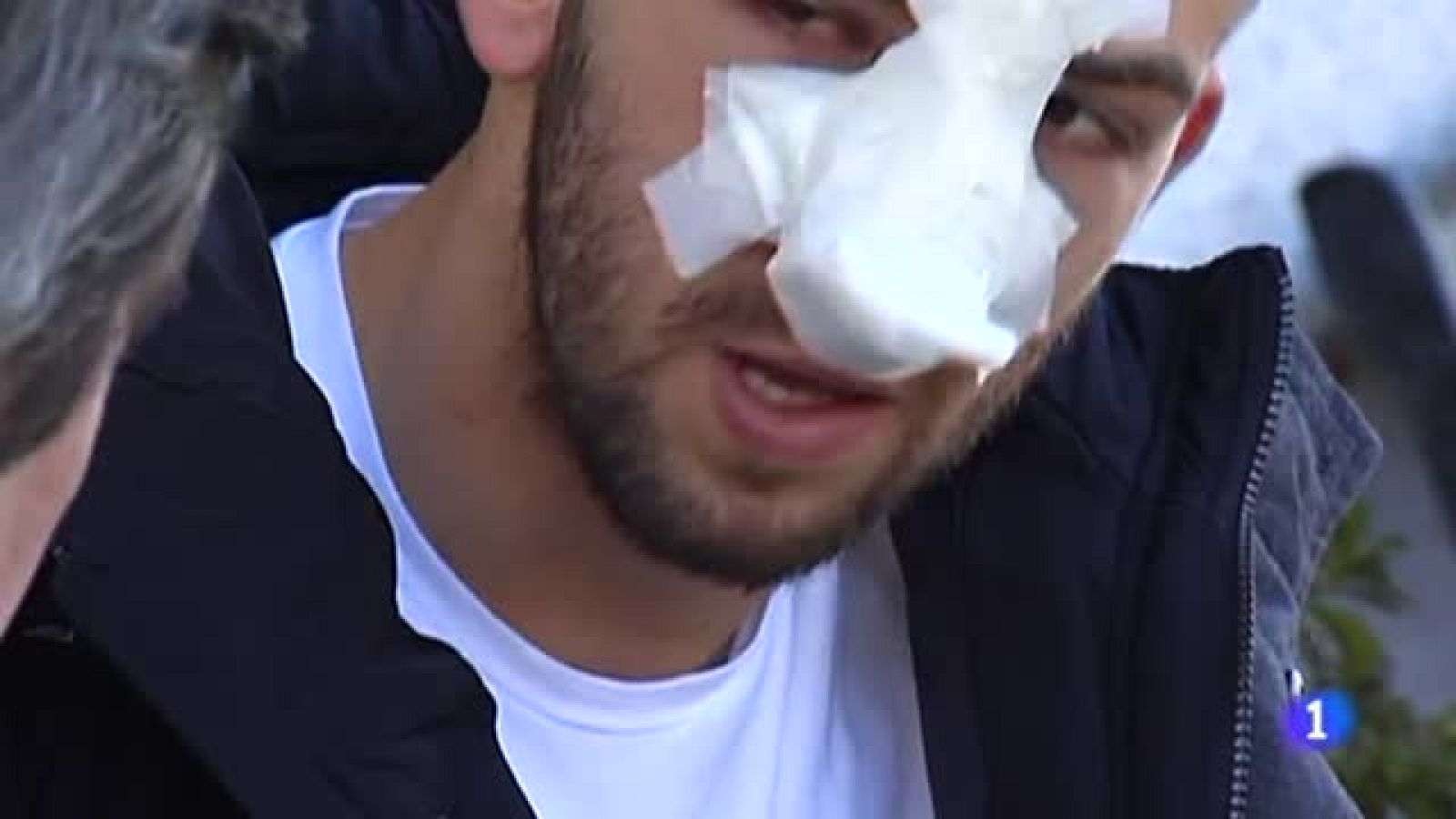 La lacra de la violencia en el fútbol ha vuelto. Ha sido en Galicia, en un partido de tercera entre el Guillarei y el Xinzo de Ponteareas. A un jugador le destrozaron la cara.