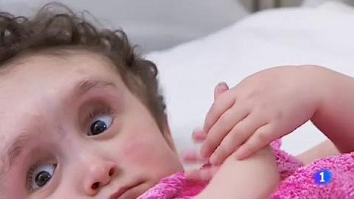 La historia de Malak, una niña de dos años sometida a una intervención de altísimo riesgo 
