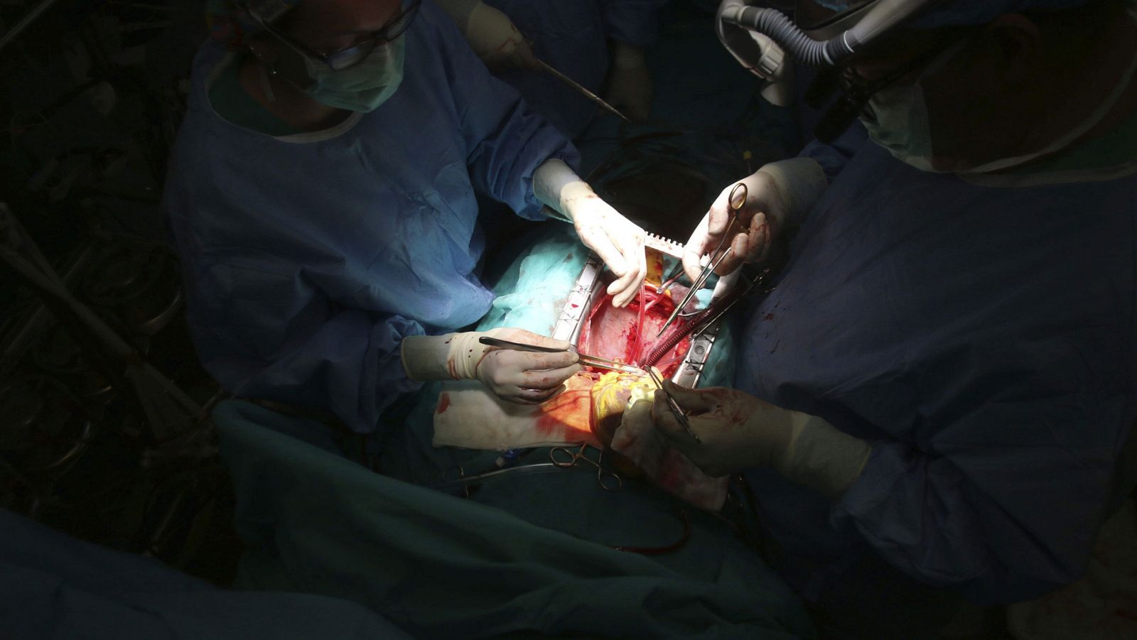 Holanda aprueba una ley para convertir en donantes de órganos a todos sus ciudadanos mayores de 18 años