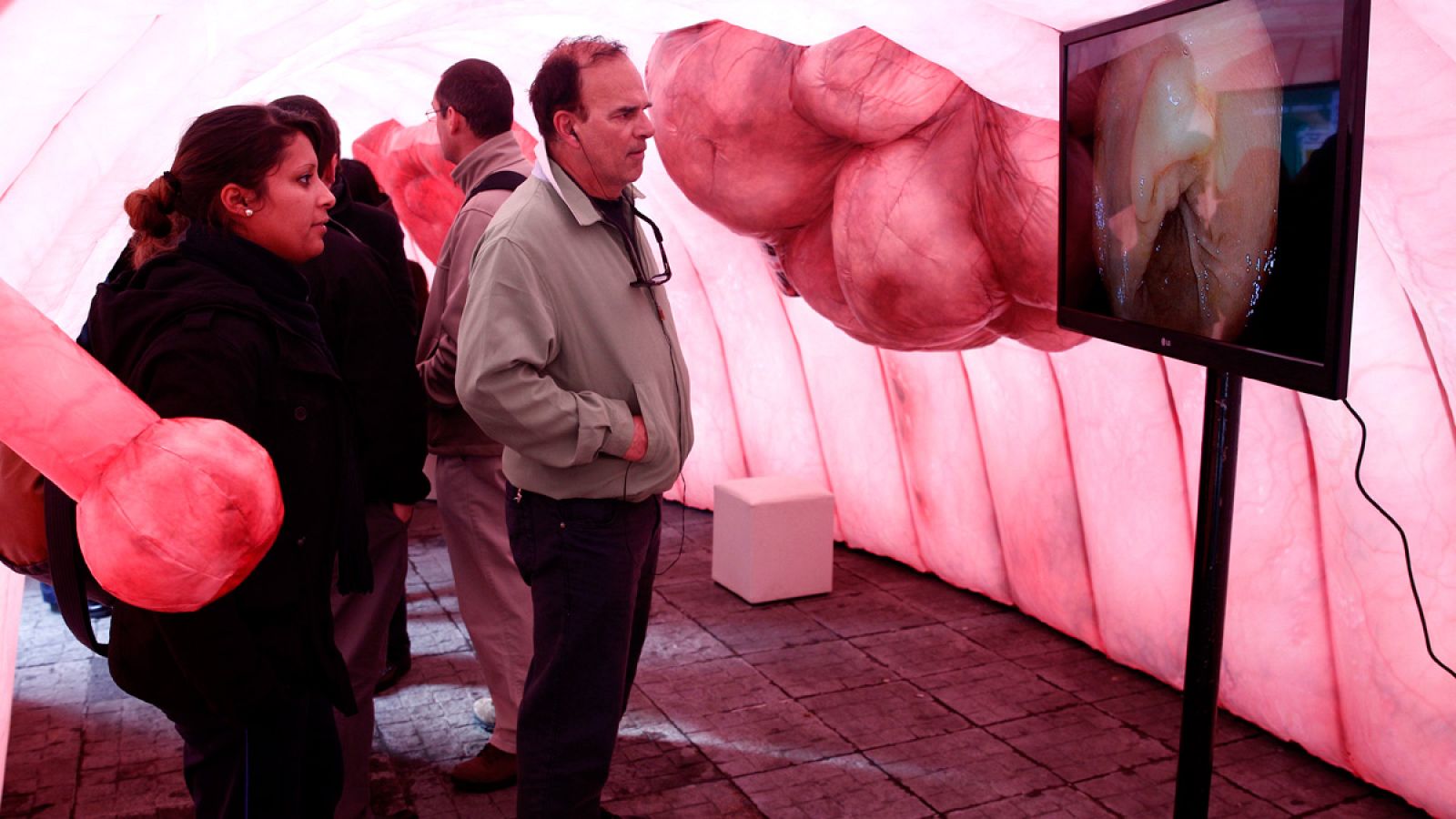 El cáncer de colon es el de mayor incidencia entre hombres y mujeres en España