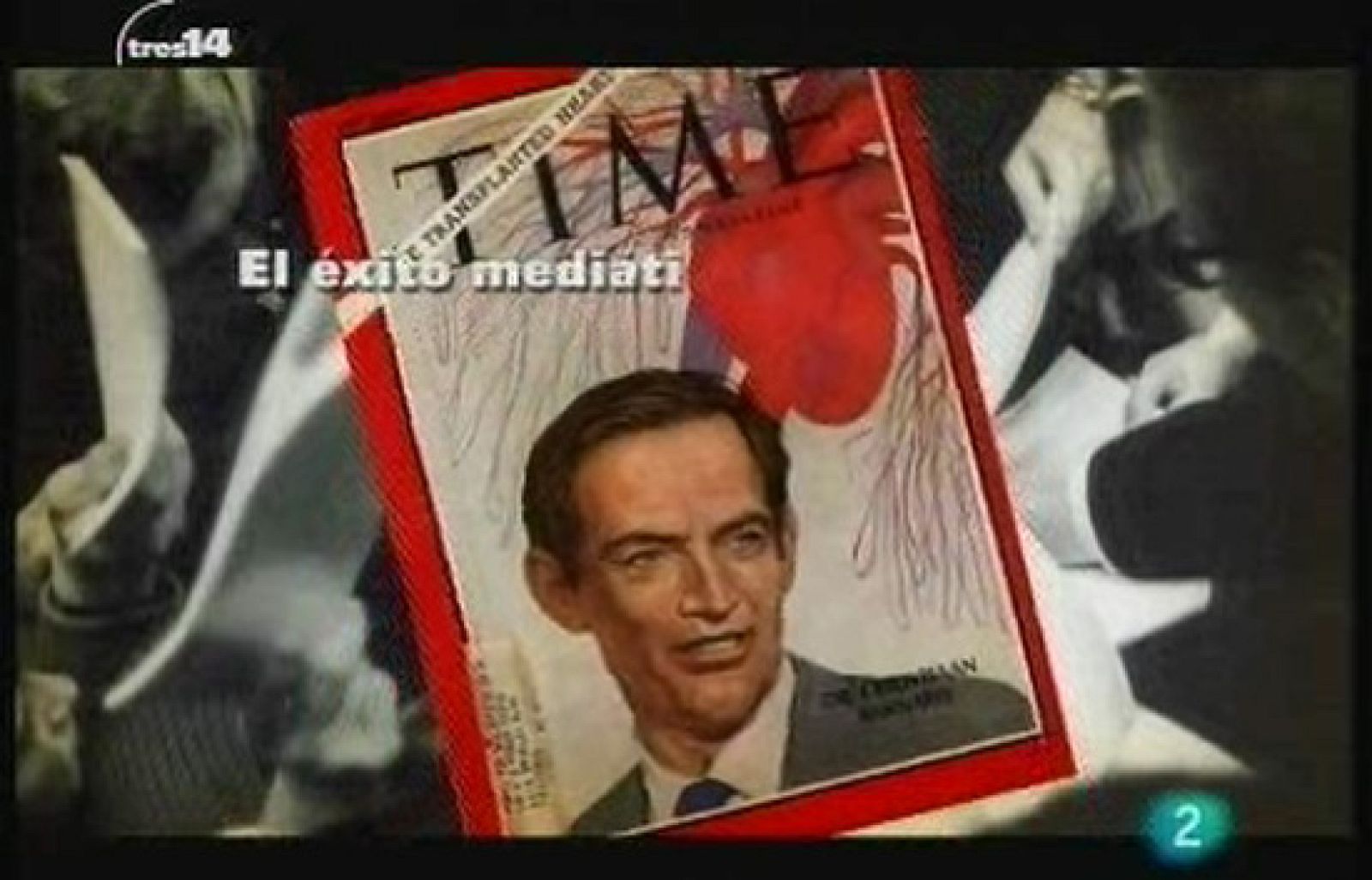 El primer trasplante de corazón (Corazón)