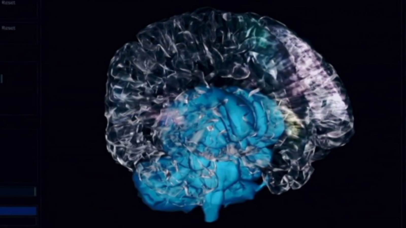 Zoom Net - Música neuronal; 18:9 y doble cámara; Playstations Talents - ver ahora