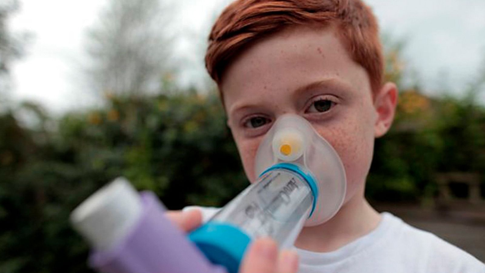 Documenta2 - Horizon. Alergias: La vida moderna y yo - ver ahora