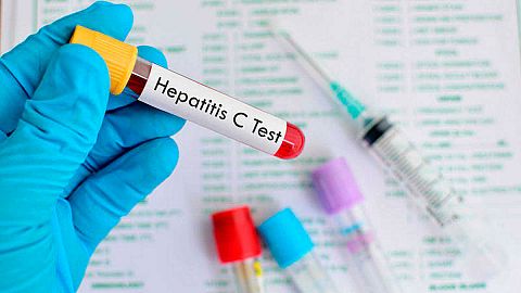 Hoy se celebra en todo el mundo el día de la hepatitis