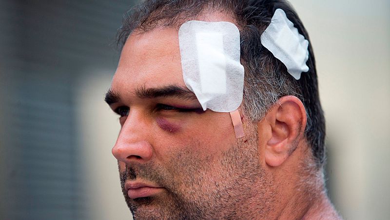 Los mossos investigan la agresión de unos manteros a un turista norteamericano en Barcelona