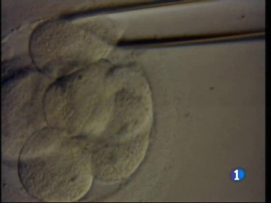 Ciencia y tecnología en Rtve.es - Extraer células madre
