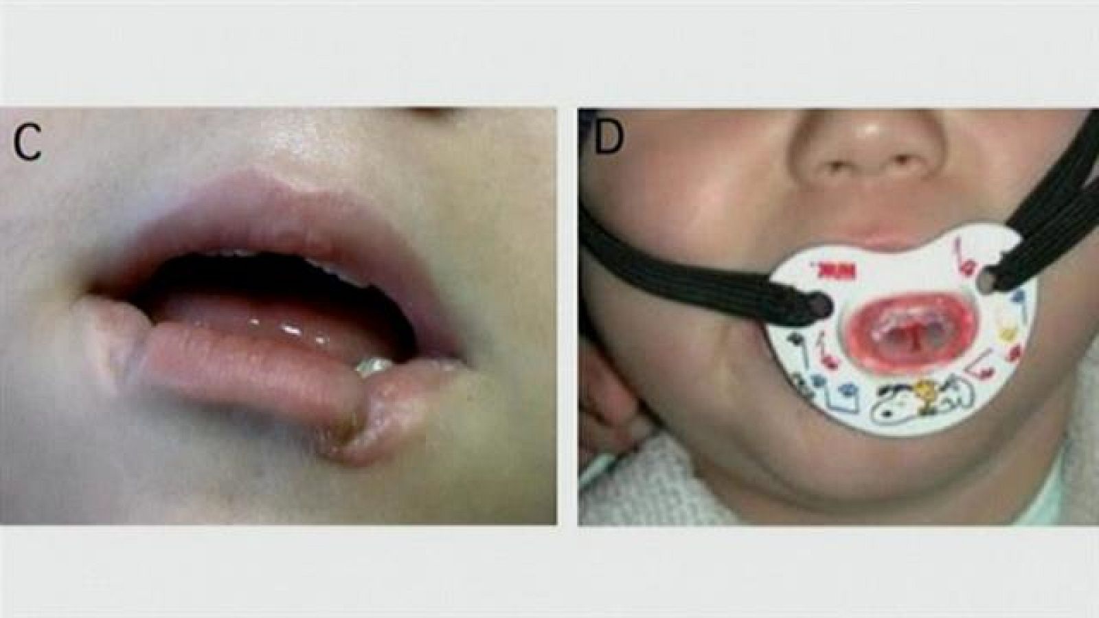 Canarias en 2' - 21/09/2018