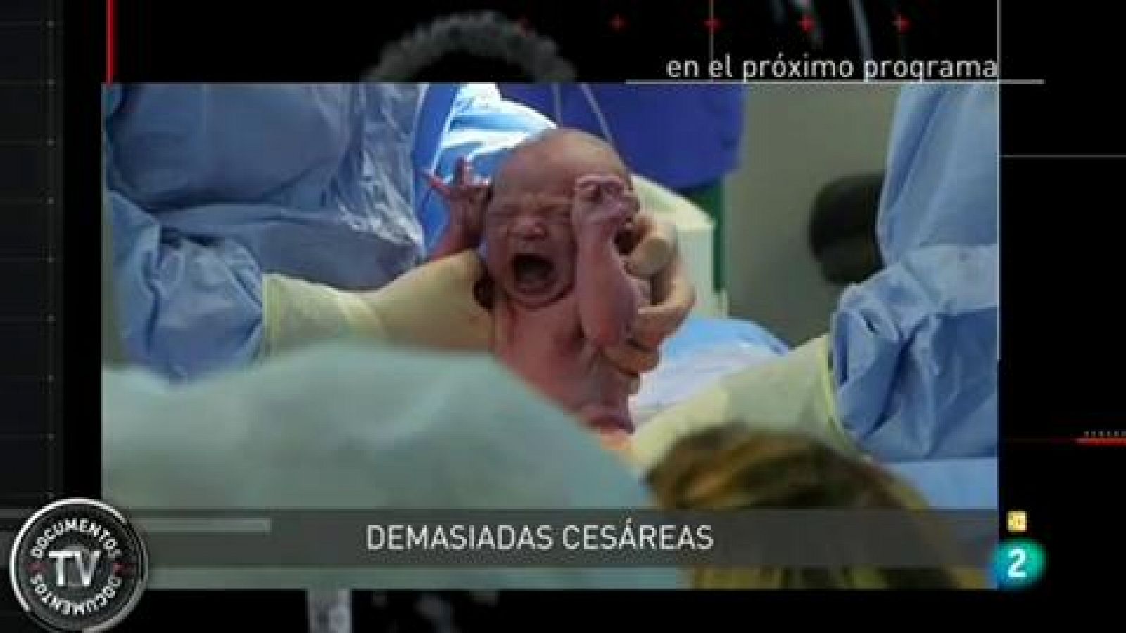 Documentos TV: Demasiadas cesáreas - avance | RTVE Play