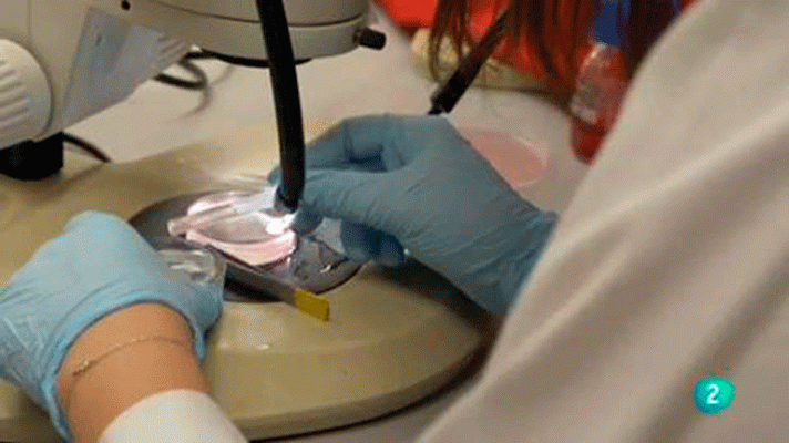 La aventura del Saber - Universo Sostenible: ¿Cómo envejece el cerebro?