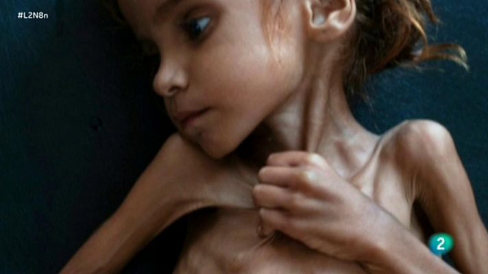 Yemen se muere de hambre