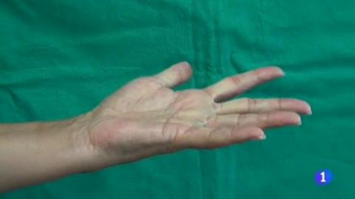 Telediario 1 - Distrofia de Sudeck, una enfermedad que provoca incapacidad y grandes dolores