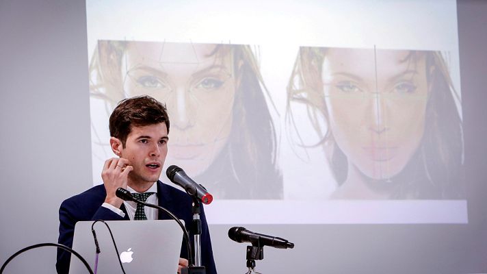 Telediario 1 - Un equipo médico de Valencia realiza un cambio de sexo en una única cirugía de 17 horas