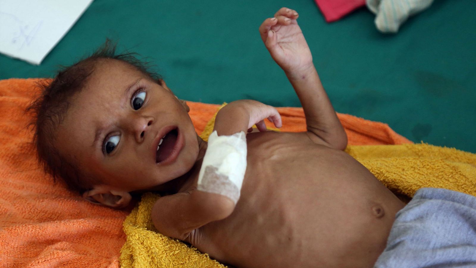 Yemen: Casi 85.000 niños han muerto de hambre en Yemen - RTVE.es