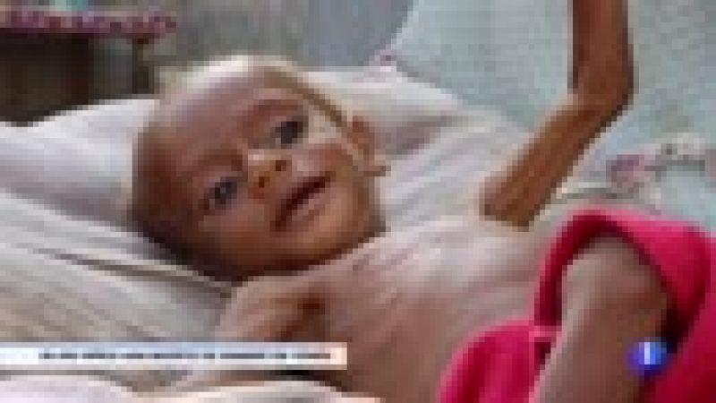 Casi 85.000 niños han muerto de hambre en Yemen