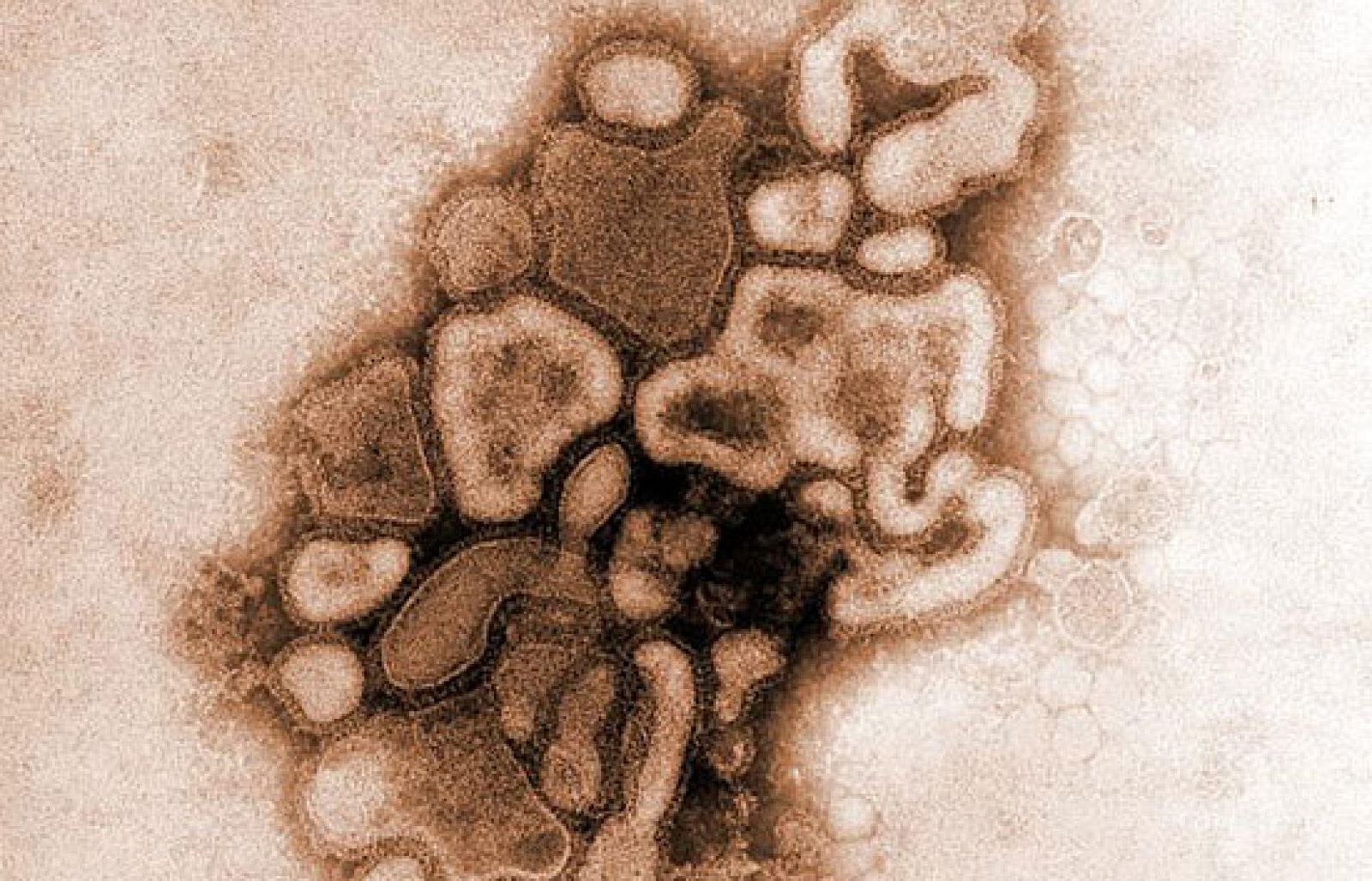 Al menos 60 personas han muerto en México por la peste porcina.