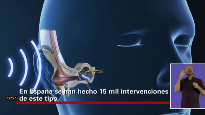 Repor - Romper el silencio