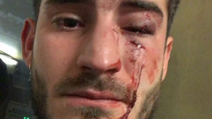 Telediario 1 - Dos detenidos por una agresión supuestamente homófoba en el metro de Barcelona