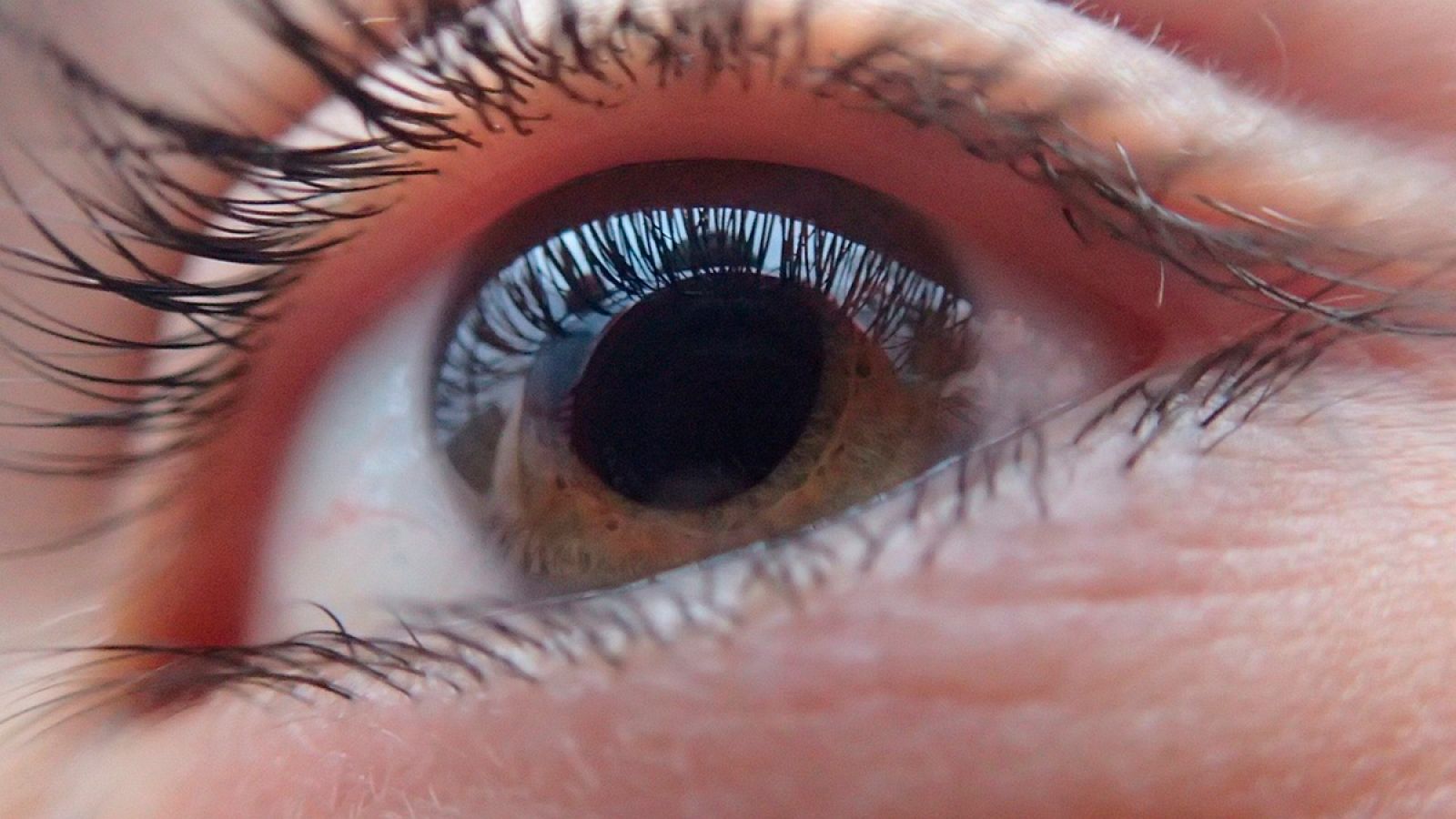 Vídeo: Un simulador permite saber cómo el paciente verá antes de una cirugía ocular - RTVE.es