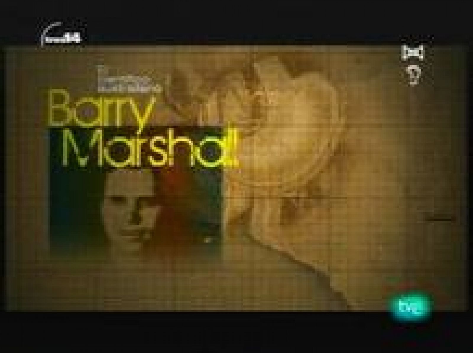 la Helicobacter pylori (al límite)