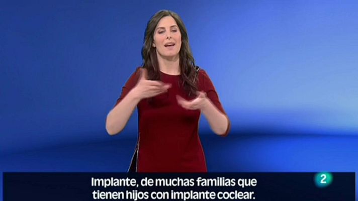 En lengua de signos - Asociación t-oigo en el circo El Día del Implante Coclear