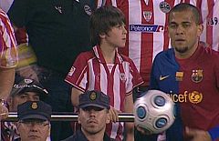 Botellazo a Alves