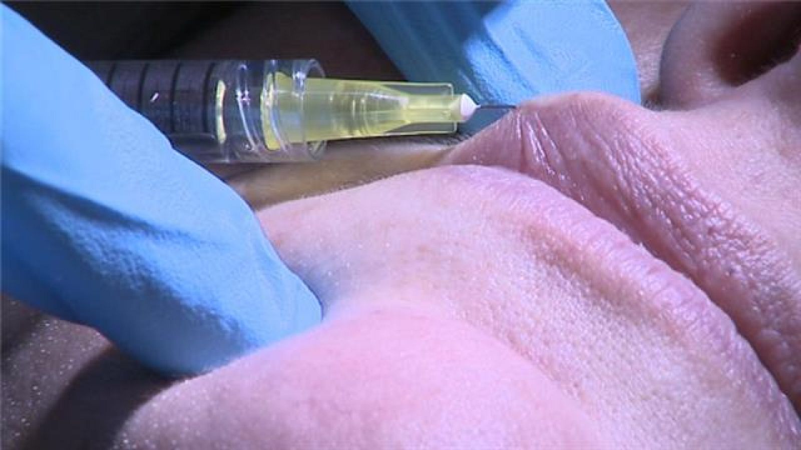 Telecanarias - 19/03/2019