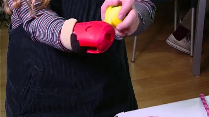 Prótesis de brazo de bajo coste con impresoras 3D