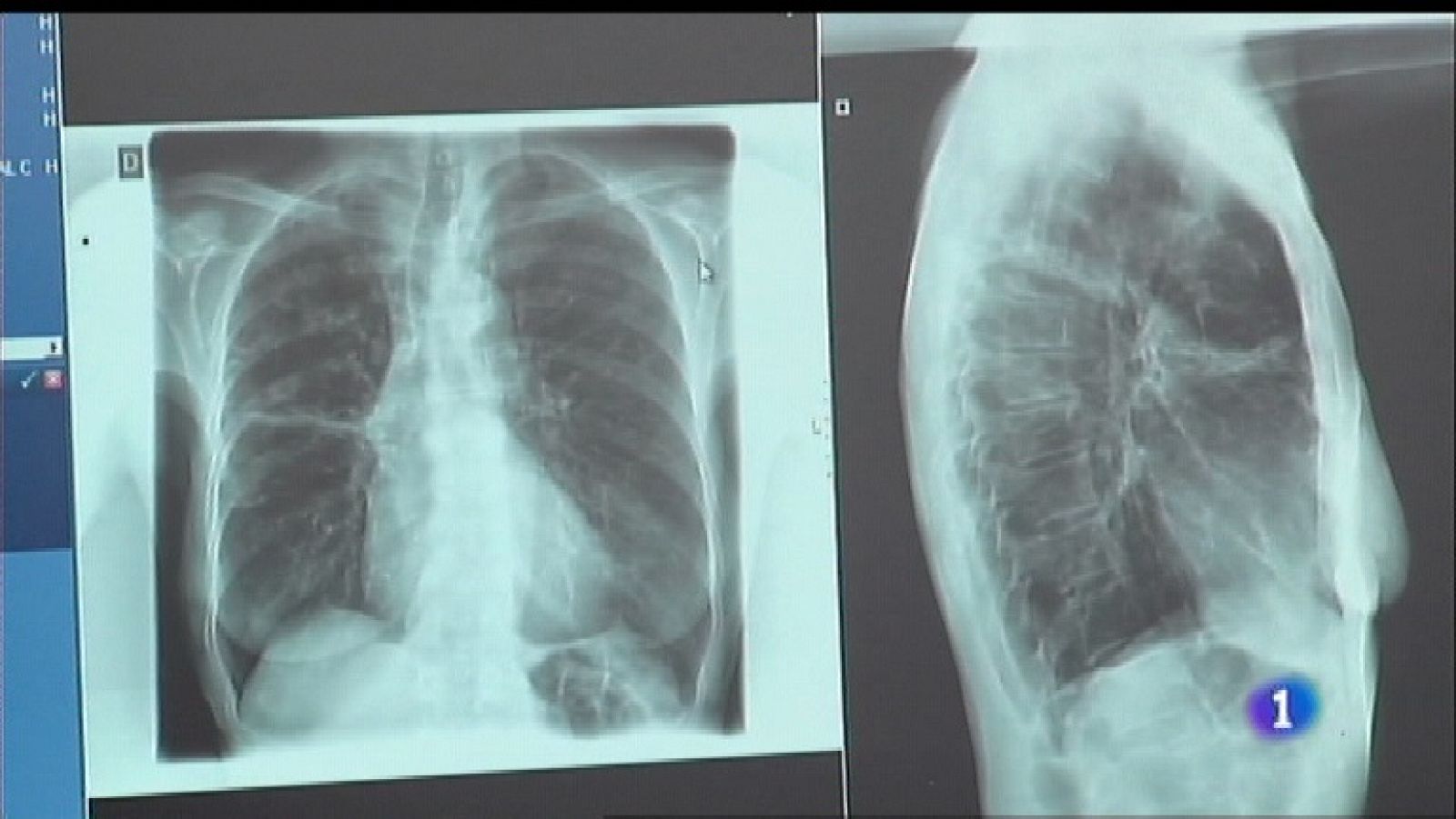 Panorama Regional 2 - 28/03/19 | Ver