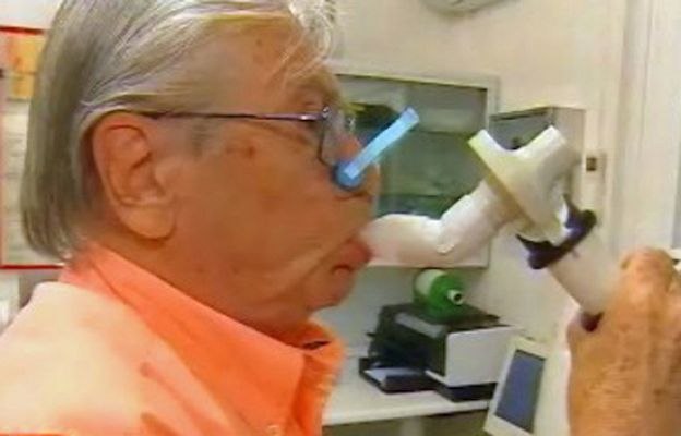 España Directo - ¿Por qué soy alérgico?