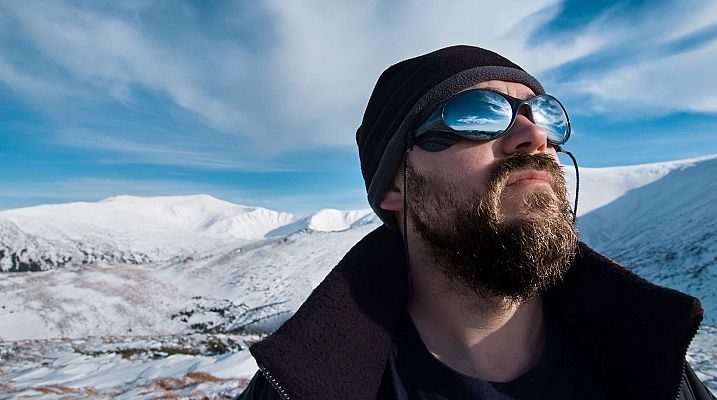 Telediario 1 - La 'ceguera de las nieves', una lesión con fácil prevención que puede provocar la pérdida de visión